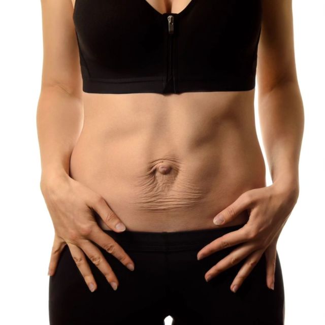 Que faire enceinte 🤰 pour éviter le diastasis ou éviter de l'aggraver ?  Le diastasis correspond à l'écartement des abdominaux 🍫  Peut-on faire des abdos pour prévenir l'écartement ? 🤰  OUI 👍 mais pas n'importe lesquels car certains types d'abdos peuvent au contraire aggraver le diastasis ! ⚠️  Garder une bonne sangle abdominale enceinte est important pour prévenir du diastasis mais aussi pour le mal de dos ! 
Et ... Pour l'ACCOUCHEMENT ça sert d'avoir des abdos 😉😉  @kabpreskile1 #pilatesenceinte #degasquetlamethode #methodeguillarme #yogavecmilana #etreautopenceinte #pregnant #diastase